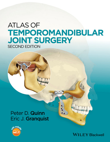 Atlas of Temporomandibular Joint Surgery book cover by 