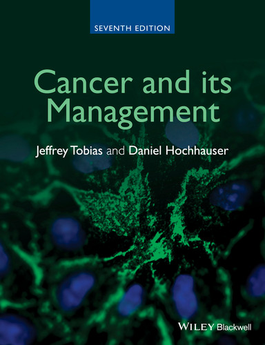 Cancer and its Management book cover by Jeffrey S. Tobias, Daniel Hochhauser