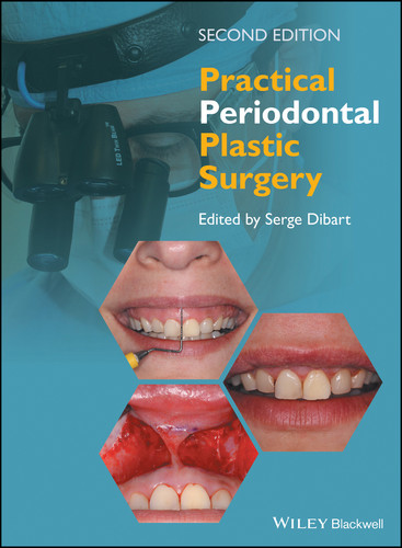 Practical Periodontal Plastic Surgery book cover by 