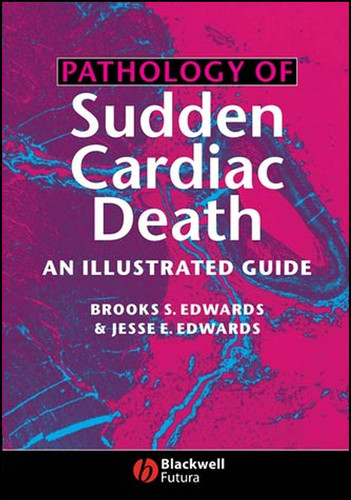 Pathology of Sudden Cardiac Death: An Illustrated Guide book cover by Brooks S. Edwards, Jesse E. Edwards