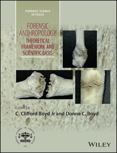 Forensic Anthropology: Theoretical Framework and Scientific Basis (Forensic Science in Focus) book cover by 