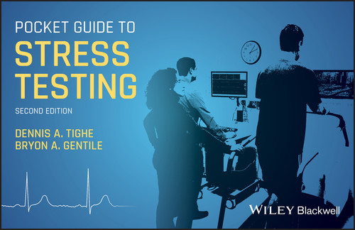 Pocket Guide to Stress Testing book cover by 