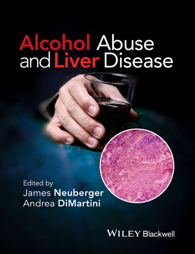 Alcohol Abuse and Liver Disease book cover by Andrea DiMartini