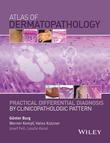 Atlas of Dermatopathology: Practical Differential Diagnosis by Clinicopathologic Pattern book cover by 