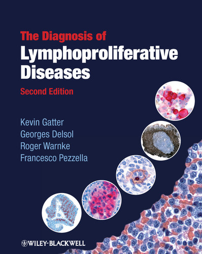 The Diagnosis of Lymphoproliferative Diseases book cover by Kevin Gatter, Georges Delsol, Roger Warnke, Francesco Pezzella