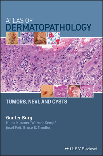 Atlas of Dermatopathology: Tumors, Nevi, and Cysts book cover by Günter Burg, Heinz Kutzner, Werner Kempf, Josef Feit, Bruce R. Smoller