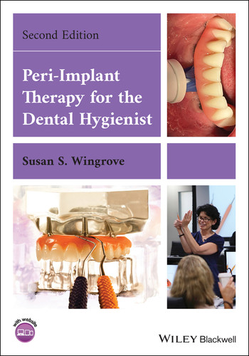 Peri-Implant Therapy for the Dental Hygienist book cover by Susan S. Wingrove