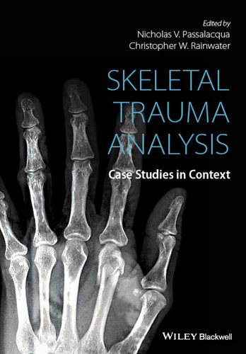 Skeletal Trauma Analysis: Case Studies in Context book cover by 