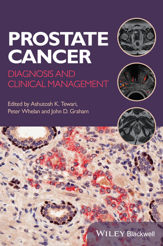 Prostate Cancer: Diagnosis and Clinical Management book cover by 
