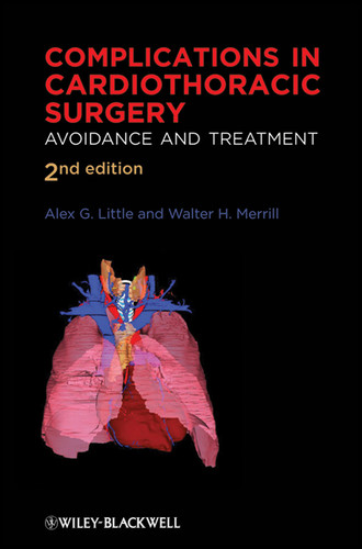 Complications in Cardiothoracic Surgery: Avoidance and Treatment book cover by 