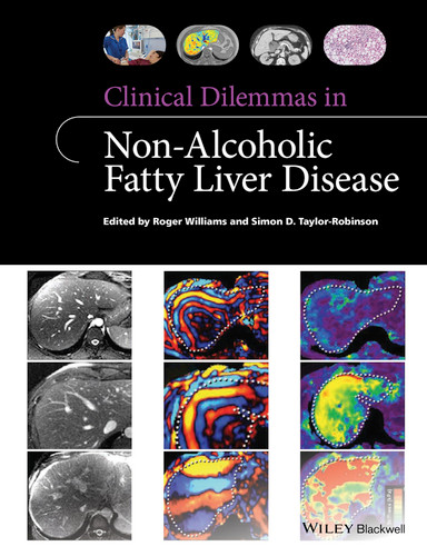 Clinical Dilemmas in Non-Alcoholic Fatty Liver Disease (Clinical Dilemmas (UK)) book cover by Roger Williams, Simon D. Taylor-Robinson