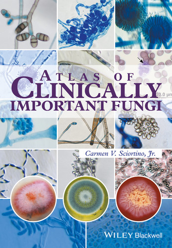 Atlas of Clinically Important Fungi book cover by Carmen V. Sciortino, Jr.