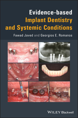 Evidence-based Implant Dentistry and Systemic Conditions book cover by Fawad Javed, Georgios E. Romanos