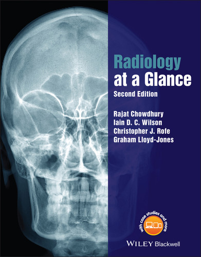 Radiology at a Glance (At a Glance) book cover by Rajat Chowdhury, Iain Wilson, Christopher Rofe, Graham Lloyd-Jones