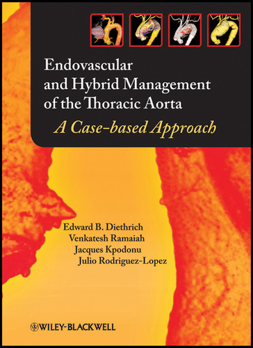 Endovascular and Hybrid Management of the Thoracic Aorta: A Case-based Approach book cover by Edward B. Diethrich, Venkatesh Ramaiah, Jacques Kpodonu, Julio A. Rodriguez-Lopez