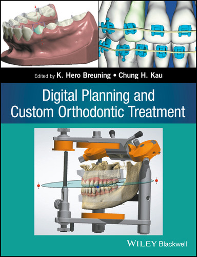 Digital Planning and Custom Orthodontic Treatment book cover by 