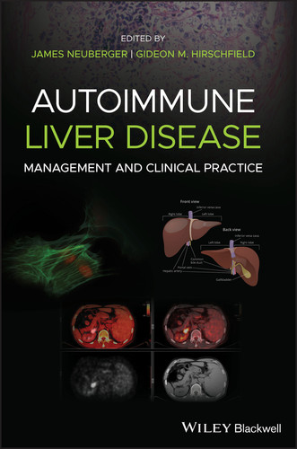 Autoimmune Liver Disease: Management and Clinical Practice book cover by 