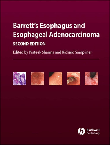 Barrett's Esophagus and Esophageal Adenocarcinoma book cover by 