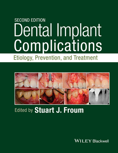 Dental Implant Complications: Etiology, Prevention, and Treatment book cover by 