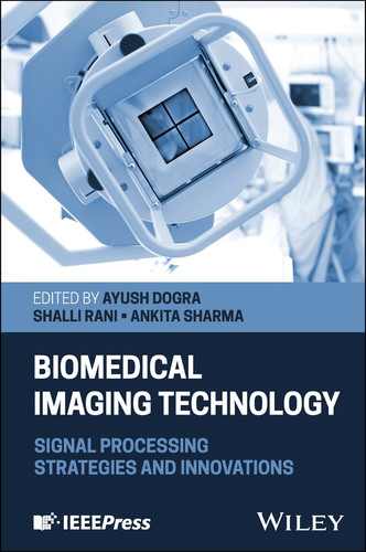 Biomedical Imaging Technology: Signal Processing Strategies and Innovations book cover by 