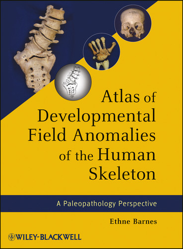 Atlas of Developmental Field Anomalies of the Human Skeleton: A Paleopathology Perspective book cover by Ethne Barnes