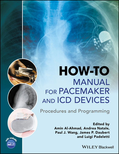 How-to Manual for Pacemaker and ICD Devices: Procedures and Programming book cover by 