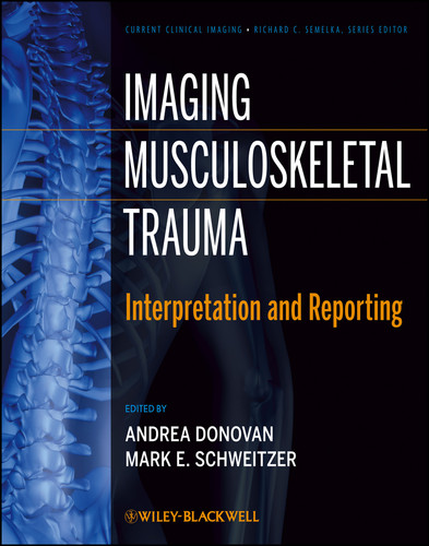Imaging Musculoskeletal Trauma: Interpretation and Reporting (Current Clinical Imaging) book cover by 