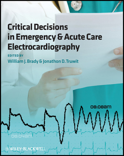 Critical Decisions in Emergency and Acute Care Electrocardiography book cover by 