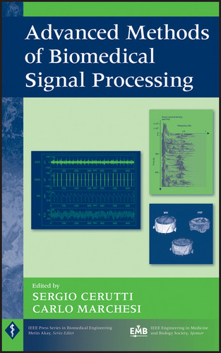 Advanced Methods of Biomedical Signal Processing (IEEE Press Series on Biomedical Engineering) book cover by 