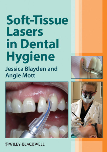 Soft-Tissue Lasers in Dental Hygiene book cover by Jessica Blayden, Angie Mott