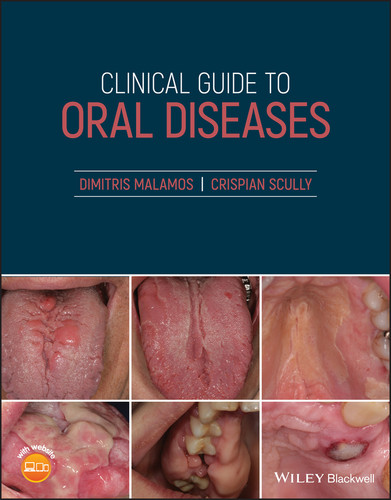 Clinical Guide to Oral Diseases book cover by Dimitris Malamos, Crispian Scully