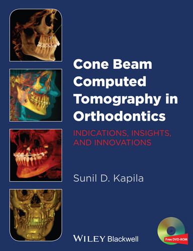 Cone Beam Computed Tomography in Orthodontics: Indications, Insights, and Innovations book cover by Sunil D. Kapila