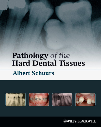 Pathology of the Hard Dental Tissues book cover by Albert Schuurs