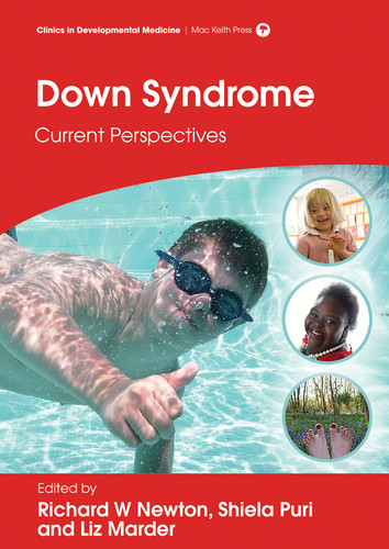 Down Syndrome: Current Perspectives (Clinics in Developmental Medicine) book cover by Richard W. Newton, Liz Marder, Shiela C. Puri