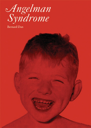 Angelman Syndrome (Clinics in Developmental Medicine) book cover by Bernard Dan