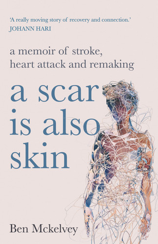 A Scar is Also Skin book cover by Ben Mckelvey