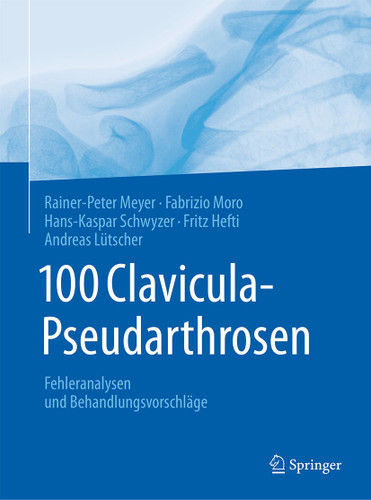100 Clavicula-Pseudarthrosen: Fehleranalysen und Behandlungsvorschläge book cover by Rainer-Peter Meyer, Fabrizio Moro, Hans-Kaspar Schwyzer, Fritz Hefti