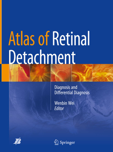 Atlas of Retinal Detachment: Diagnosis and Differential Diagnosis book cover by 