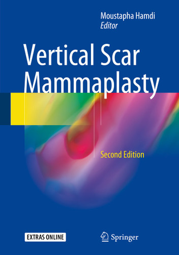 Vertical Scar Mammaplasty book cover by 