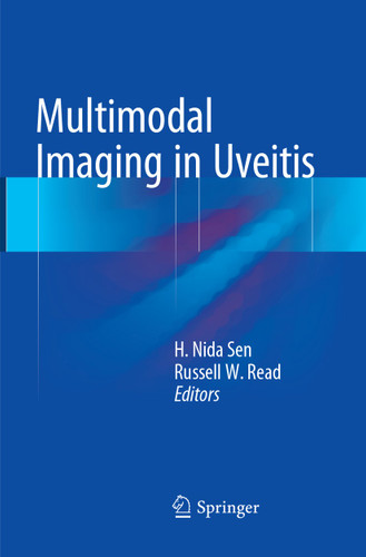 Multimodal Imaging in Uveitis book cover by 