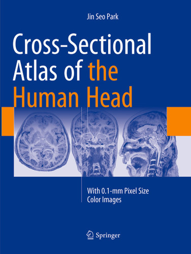 Cross-Sectional Atlas of the Human Head: With 0.1-mm pixel size color images book cover by Jin Seo Park