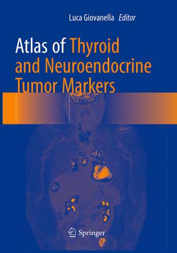 Atlas of Thyroid and Neuroendocrine Tumor Markers book cover by 
