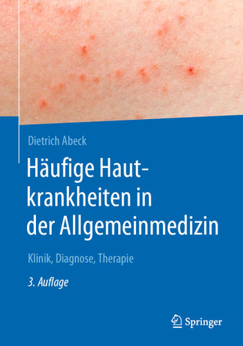 Häufige Hautkrankheiten in der Allgemeinmedizin: Klinik, Diagnose, Therapie book cover by Dietrich Abeck