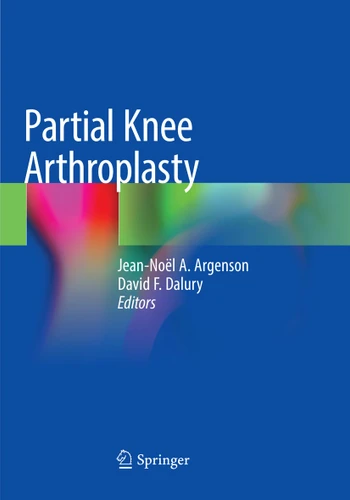 Partial Knee Arthroplasty book cover by 