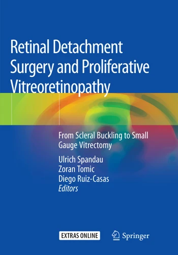 Retinal Detachment Surgery and Proliferative Vitreoretinopathy: From Scleral Buckling to Small Gauge Vitrectomy book cover by 