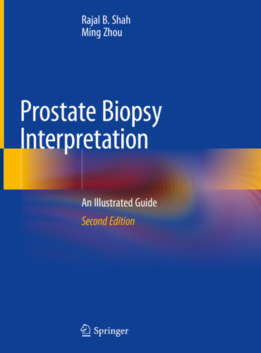 Prostate Biopsy Interpretation: An Illustrated Guide book cover by Rajal B. Shah, Ming Zhou
