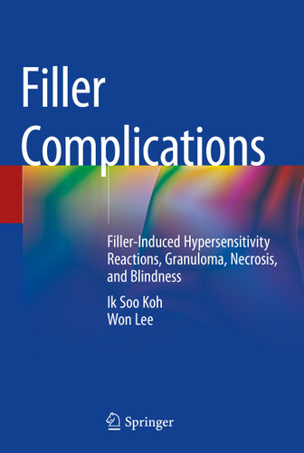 Filler Complications: Filler-Induced Hypersensitivity Reactions, Granuloma, Necrosis, and Blindness book cover by Ik Soo Koh, Won Lee
