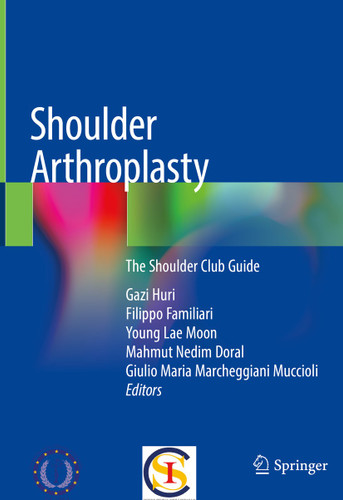 Shoulder Arthroplasty: The Shoulder Club Guide book cover by 