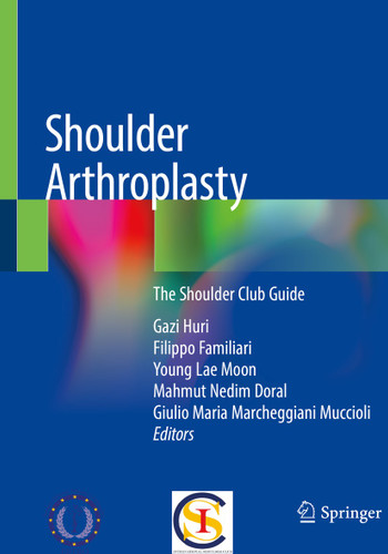 Shoulder Arthroplasty: The Shoulder Club Guide book cover by 