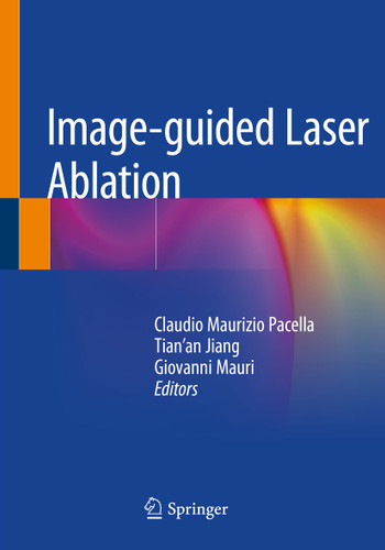 Image-guided Laser Ablation book cover by 